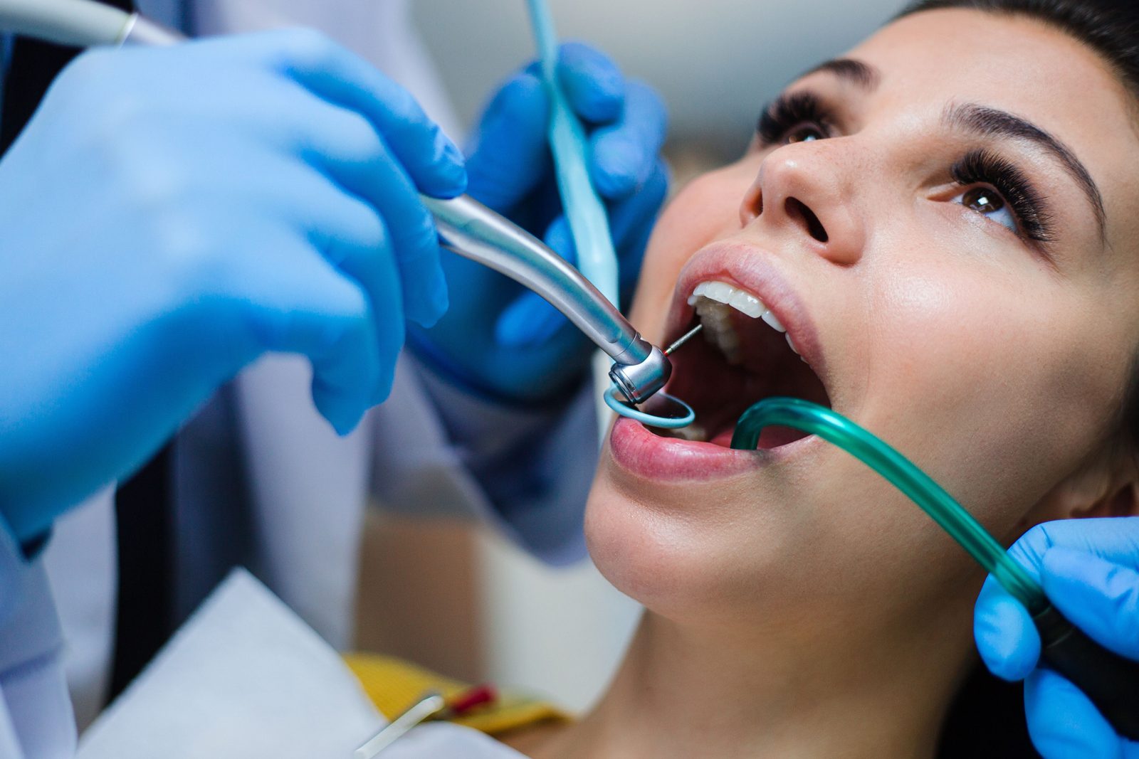 Cure conservative ed endodontiche dei denti